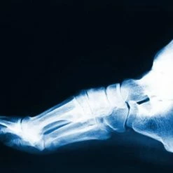 Groothandel ๐งจ MYSOLE Special Anatomical Inlegzolen Maat 41 (Per Paar) ๐ฅ 22 Groothandel ๐งจ MYSOLE Special Anatomical Inlegzolen Maat 41 (Per Paar) ๐ฅ -Nike shop 550x390